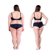 Peptide Therapy Palm Beach Gardens